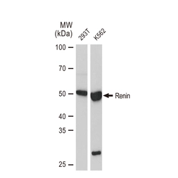Anti-Renin antibody [GT1245] used in Western Blot (WB). GTX02842