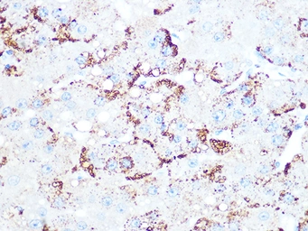 Anti-Cathepsin L/V/K/H antibody [GT1252] used in IHC (Paraffin sections) (IHC-P). GTX02849