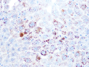 Anti-Cathepsin L/V/K/H antibody [GT1252] used in IHC (Paraffin sections) (IHC-P). GTX02849