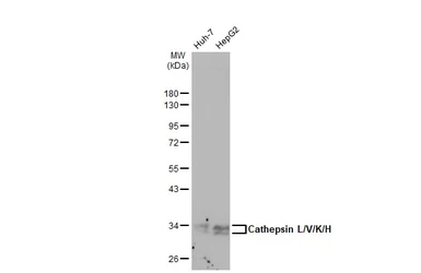 Anti-Cathepsin L/V/K/H antibody [GT1252] used in Western Blot (WB). GTX02849