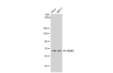 Anti-ELK1 antibody [GT1257] used in Western Blot (WB). GTX02854