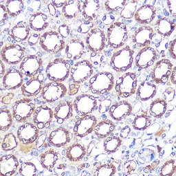 Anti-ERK5 antibody [GT1258] used in IHC (Paraffin sections) (IHC-P). GTX02855