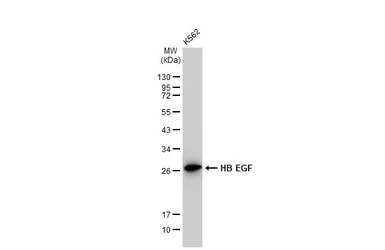 Anti-HB EGF antibody [GT1263] used in Western Blot (WB). GTX02860