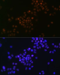 Anti-c-Myc antibody [GT1265] used in Immunocytochemistry/ Immunofluorescence (ICC/IF). GTX02877