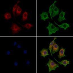 Anti-LASS2 antibody used in Immunocytochemistry/ Immunofluorescence (ICC/IF). GTX02887