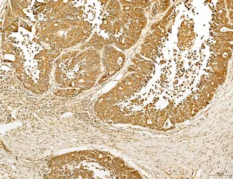Anti-LASS2 antibody used in IHC (Paraffin sections) (IHC-P). GTX02887