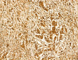 Anti-LASS2 antibody used in IHC (Paraffin sections) (IHC-P). GTX02887