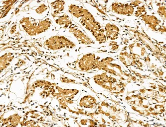 Anti-LASS2 antibody used in IHC (Paraffin sections) (IHC-P). GTX02887