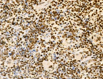 Anti-LASS2 antibody used in IHC (Paraffin sections) (IHC-P). GTX02887