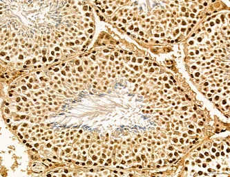Anti-LASS2 antibody used in IHC (Paraffin sections) (IHC-P). GTX02887