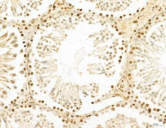 Anti-LASS2 antibody used in IHC (Paraffin sections) (IHC-P). GTX02887