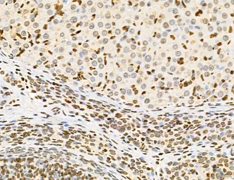 Anti-LASS2 antibody used in IHC (Paraffin sections) (IHC-P). GTX02887