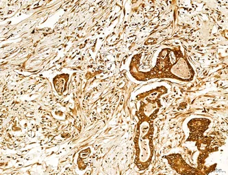 Anti-LASS2 antibody used in IHC (Paraffin sections) (IHC-P). GTX02887