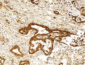 Anti-LASS2 antibody used in IHC (Paraffin sections) (IHC-P). GTX02887