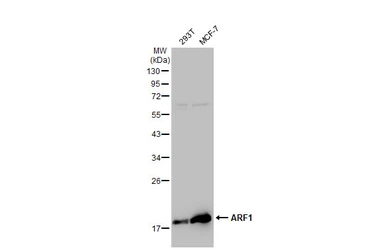 Anti-ARF1 antibody [GT1269] used in Western Blot (WB). GTX03181