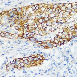 Anti-COL17A1 antibody [GT1273] used in IHC (Paraffin sections) (IHC-P). GTX03185