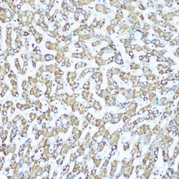Anti-CPS1 antibody [GT1274] used in IHC (Paraffin sections) (IHC-P). GTX03186