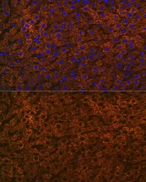 Anti-CPS1 antibody [GT1274] used in IHC (Paraffin sections) (IHC-P). GTX03186