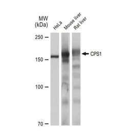 Anti-CPS1 antibody [GT1274] used in Western Blot (WB). GTX03186