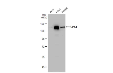 Anti-CPS1 antibody [GT1274] used in Western Blot (WB). GTX03186