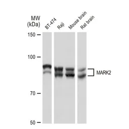 Anti-MARK2 antibody [GT1279] used in Western Blot (WB). GTX03191