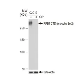 Anti-RPB1 CTD (phospho Ser2) antibody [GT1302] used in Western Blot (WB). GTX03214
