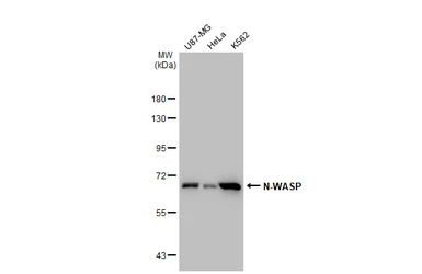 Anti-N-WASP antibody [GT1328] used in Western Blot (WB). GTX03240