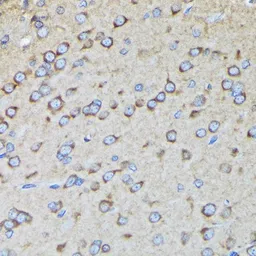 Anti-RALBP1 antibody [GT1337] used in IHC (Paraffin sections) (IHC-P). GTX03249