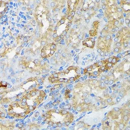 Anti-RALBP1 antibody [GT1337] used in IHC (Paraffin sections) (IHC-P). GTX03249