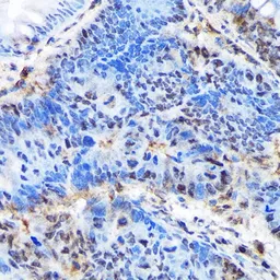 Anti-Ctip1 antibody [GT1341] used in IHC (Paraffin sections) (IHC-P). GTX03253