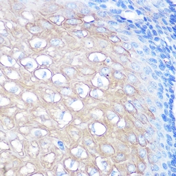 Anti-CD168 / RHAMM antibody [GT1346] used in IHC (Paraffin sections) (IHC-P). GTX03261