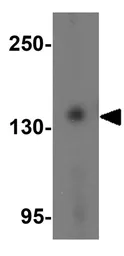 Anti-PRDM16 antibody used in Western Blot (WB). GTX03275