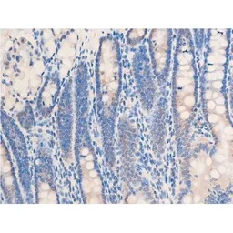 Anti-Chk2 (phospho Thr68) antibody used in IHC (Paraffin sections) (IHC-P). GTX03351