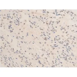 Anti-Chk2 (phospho Thr68) antibody used in IHC (Paraffin sections) (IHC-P). GTX03351