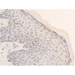 Anti-Chk2 (phospho Thr68) antibody used in IHC (Paraffin sections) (IHC-P). GTX03351
