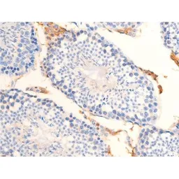Anti-Chk2 (phospho Thr68) antibody used in IHC (Paraffin sections) (IHC-P). GTX03351