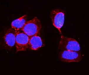 Anti-Alkaline Phosphatase (Tissue Non-Specific) antibody used in Immunocytochemistry/ Immunofluorescence (ICC/IF). GTX03390