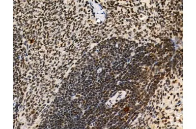 Anti-Ki67 (phospho Thr1335) antibody used in IHC (Paraffin sections) (IHC-P). GTX03435