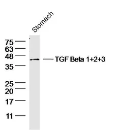 Anti-TGF beta antibody used in Western Blot (WB). GTX03464