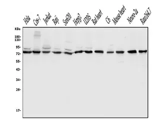 Anti-DLL1 antibody used in Western Blot (WB). GTX03469