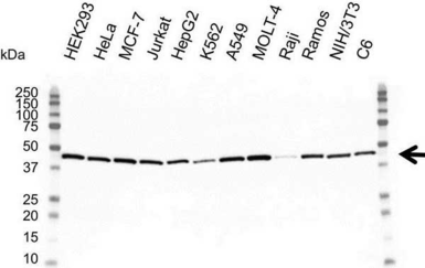 Anti-Actin Gamma 1 antibody [2A3] used in Western Blot (WB). GTX03493