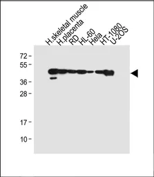Anti-MyoD1 antibody used in Western Blot (WB). GTX03495