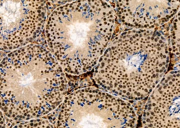 Anti-Suppressor of Fused antibody used in IHC (Paraffin sections) (IHC-P). GTX03498
