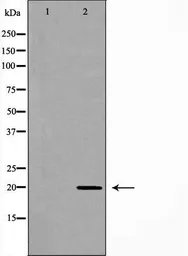 Anti-RAMP2 antibody used in Western Blot (WB). GTX03586