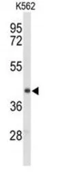 Anti-ENTPD2 antibody used in Western Blot (WB). GTX03639