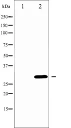 Anti-Neutrophil elastase antibody used in Western Blot (WB). GTX03640