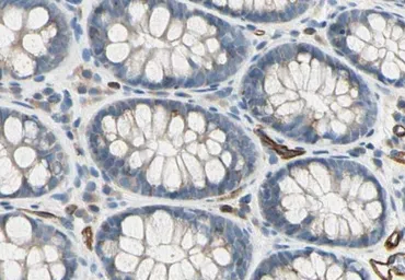 Anti-CD93 antibody used in IHC (Paraffin sections) (IHC-P). GTX03674