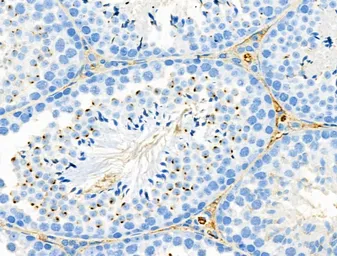 Anti-RanBP17 antibody used in IHC (Paraffin sections) (IHC-P). GTX03675
