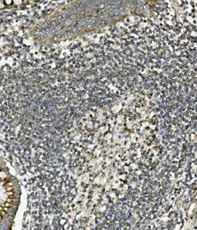 Anti-SGK1 antibody used in IHC (Paraffin sections) (IHC-P). GTX03696