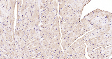 Anti-AMPK alpha 1 (phospho Thr183) + AMPK alpha 2 (phospho Thr172) antibody used in IHC (Paraffin sections) (IHC-P). GTX03702